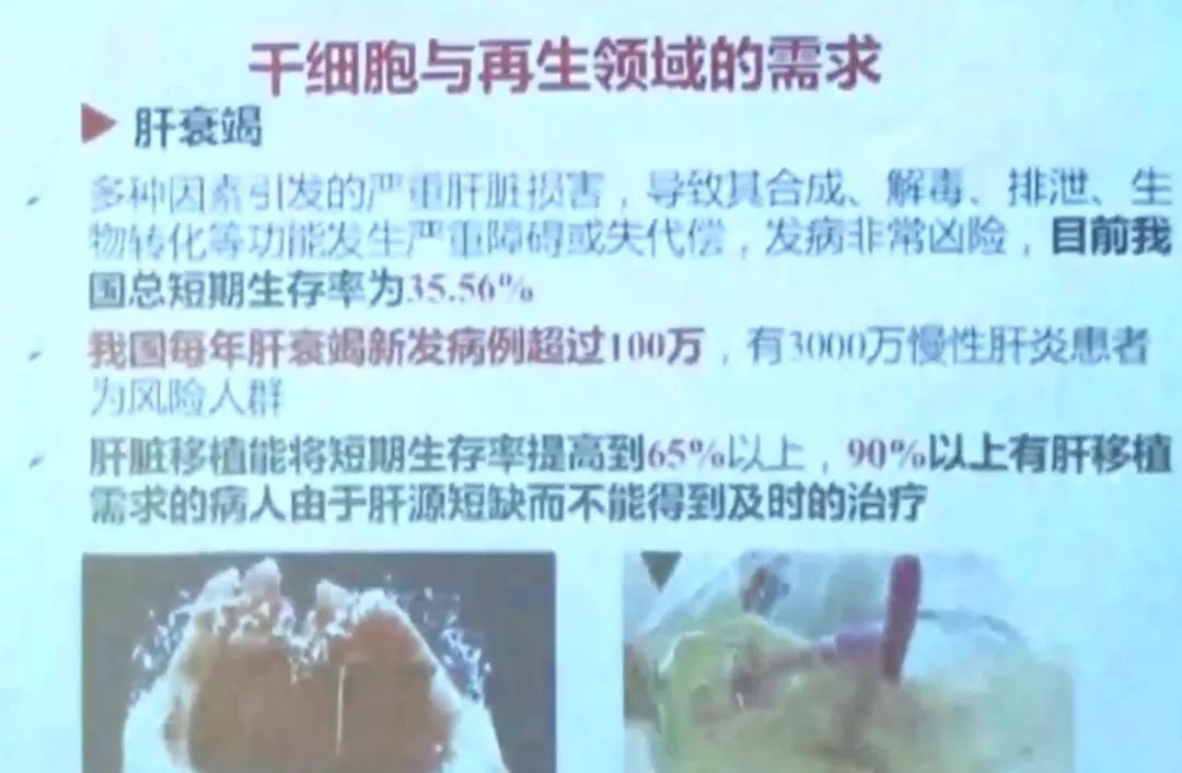 实验报告，比较绒毛与针毛的差异